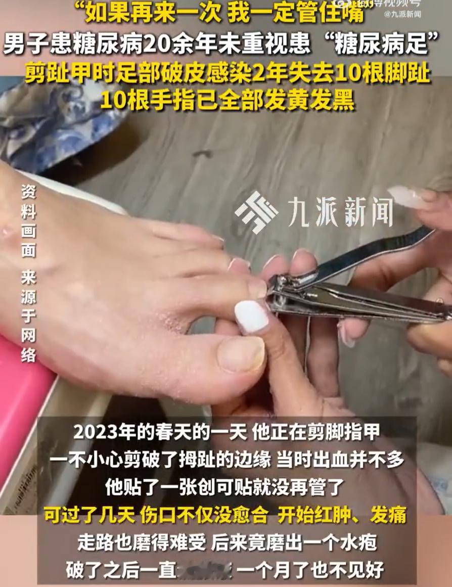 “万万没想到！”男子查出有糖尿病，可无论家人如何劝阻，在他看来都是小事，对于吃的