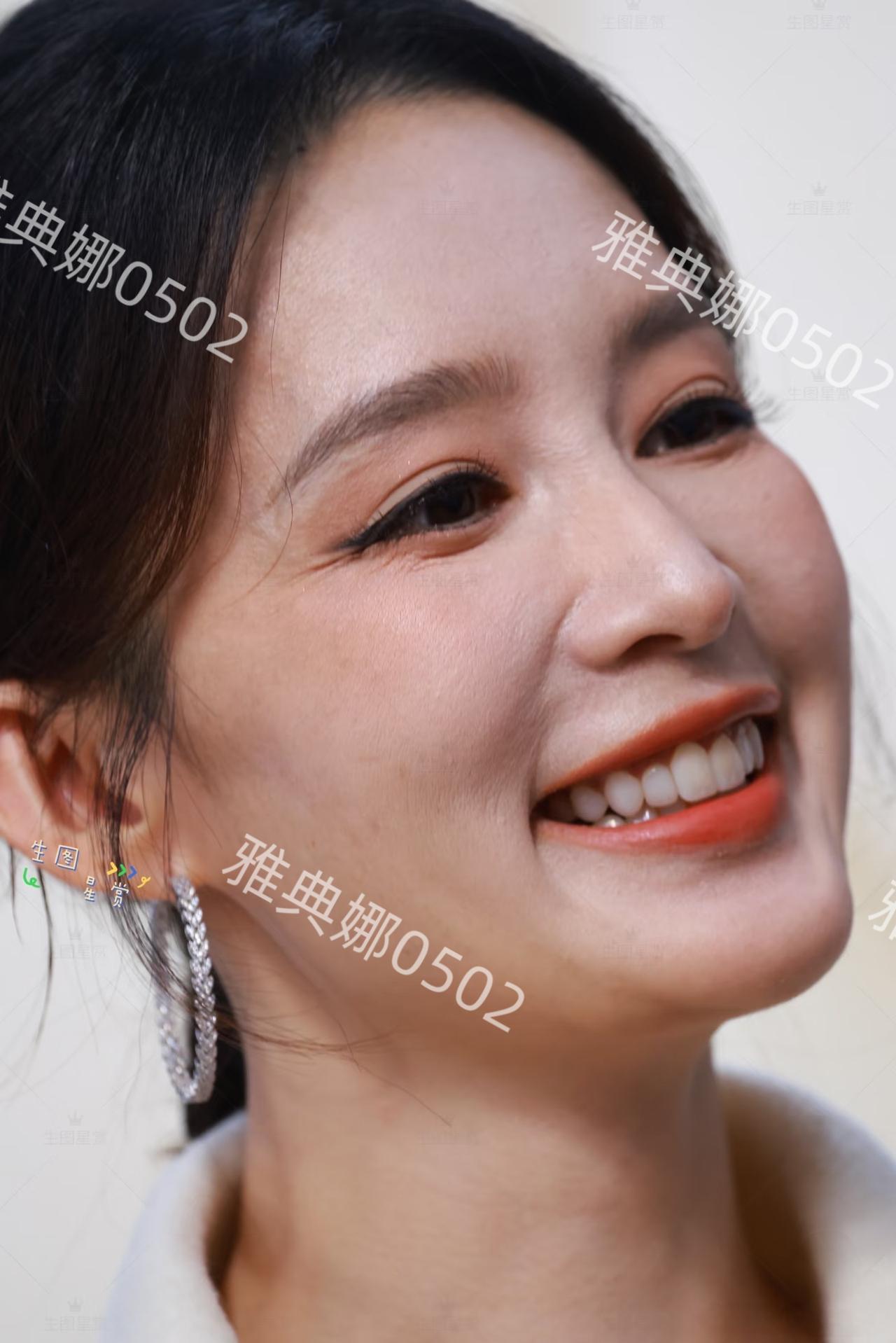 李沁的牙齿好黄脸也发腮了，女明星过了35岁颜值真的会断崖式的下跌，年龄感也会急