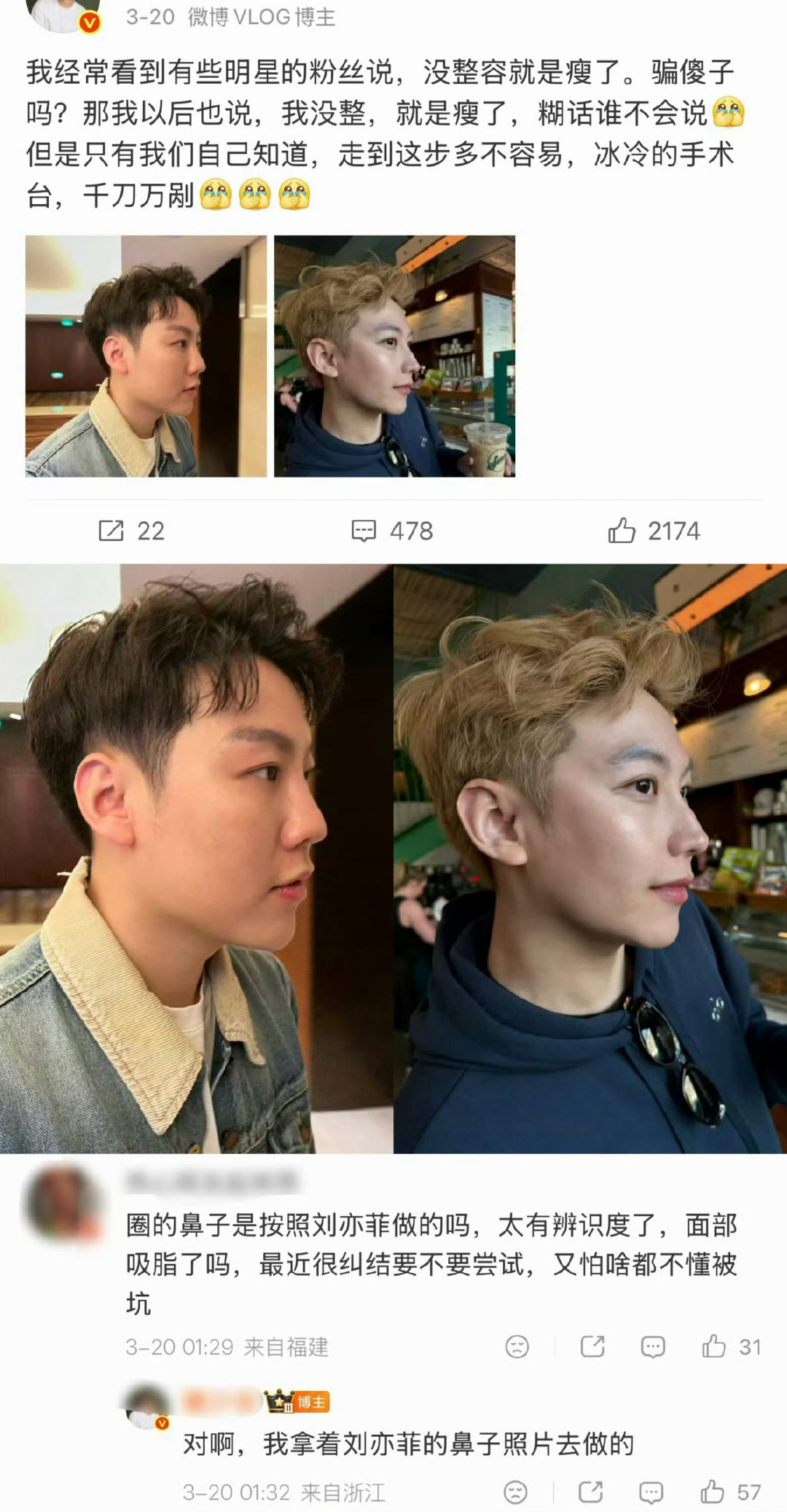 #刘亦菲五官单看一般合在一起绝了#这种明褒暗贬的洗脑手段，营销稿怎么还在嘴硬啊！刘亦菲高颅顶头包脸、