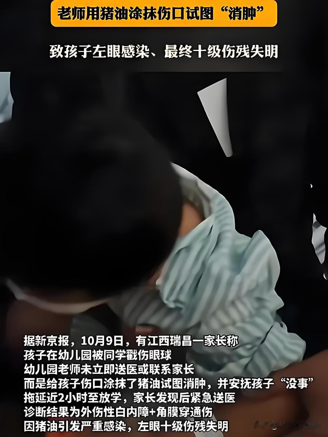 央视报道了江西幼儿园戳眼事件。一名5岁男孩在幼儿园活动期间，左眼被铅笔戳伤，老师