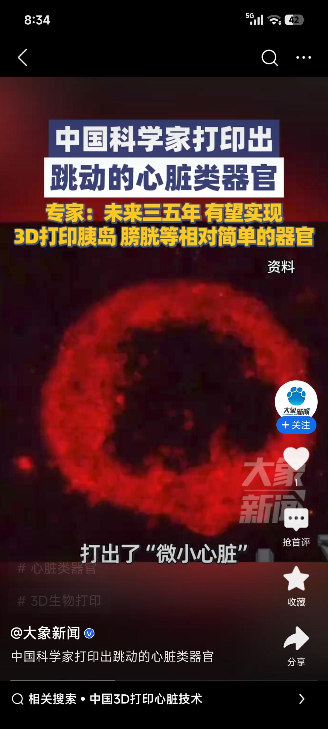 中国科学家打印出跳动心脏类器官，这简直太牛了！这意味着在医学领域又有了重大突破。