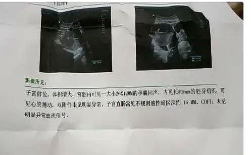 崩溃！三胎又是闺女，老公问是不是他有问题…家人们，我快愁死了！三胎产检结