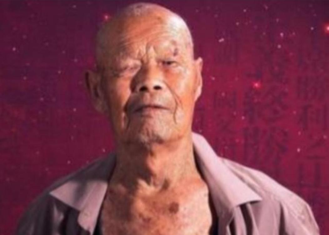 1956年，35岁农民咳嗽10年，竟拒绝就医，一天，他突然用力咳嗽，“哇”的一声