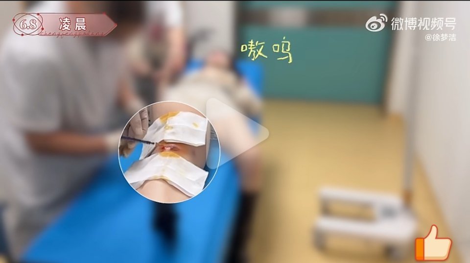 我不懂，怎么会磕成这样