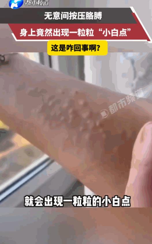 太吓人了！河南，一位网友洗完澡后只是无意间按了一下自己的胳膊，谁承想，皮肤底下竟