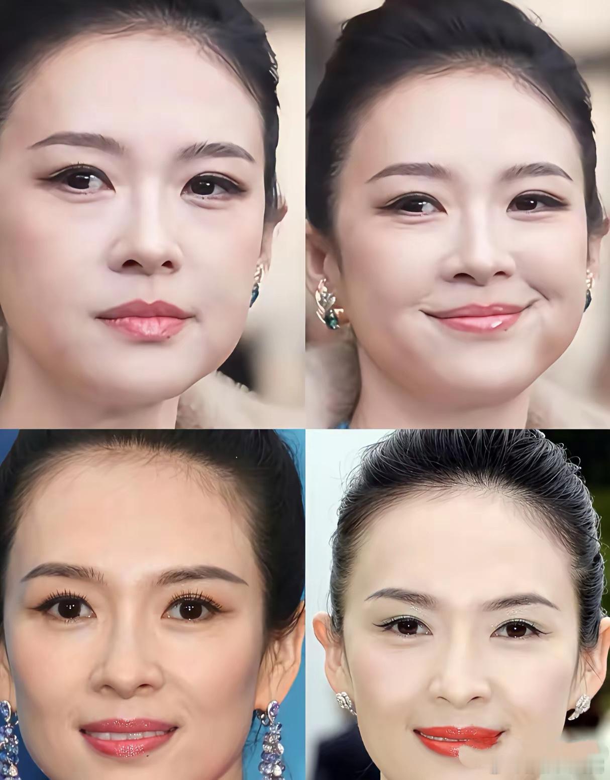 章子怡这张脸看着越来越美了，卧蚕应该也是新做的，整个五官大了一轮，大家能看出来具