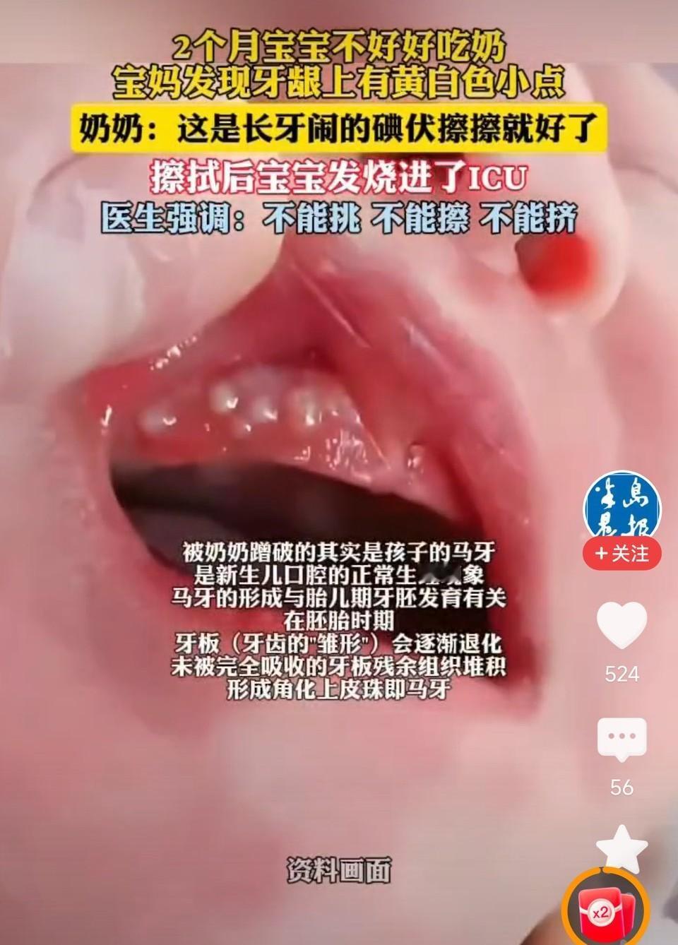 2个月宝宝被奶奶擦碘伏进ICU！这事能全怪奶奶么？不懂去医院啊，为什么要听婆婆