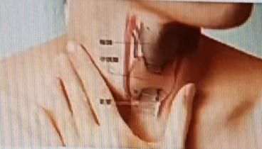 甲状腺问题可不能忽视，好多征兆其实身体早有暗示。要是莫名焦虑、烦躁不安，可能是