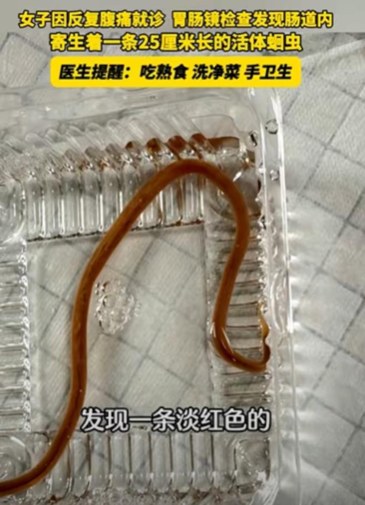 真是奇了怪了！浙江金华，40多岁的女子肚子疼，以为是普通拉肚子，自己买了止泻药吃