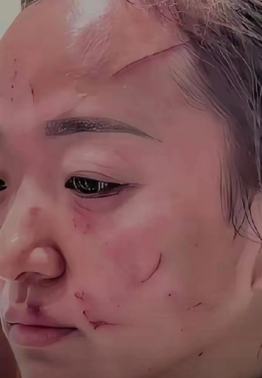 女婿昨天把女儿打了，我气的问啥原因，为什么敢打我的宝贝女儿，女婿说，女儿每天下班