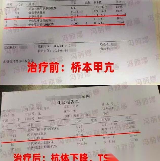 体检报告一出来，那个叫“抗体”的箭头，直接飙到1000多。魂儿都吓飞了。医生