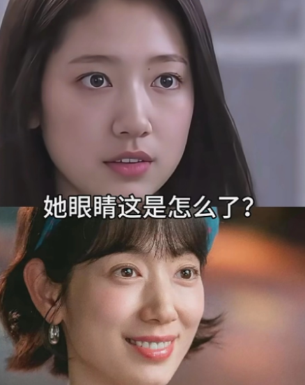 原来明星也一样，朴信惠感觉跟以前不一样了，人到了一定年纪，眼球就是会变，眼珠子颜