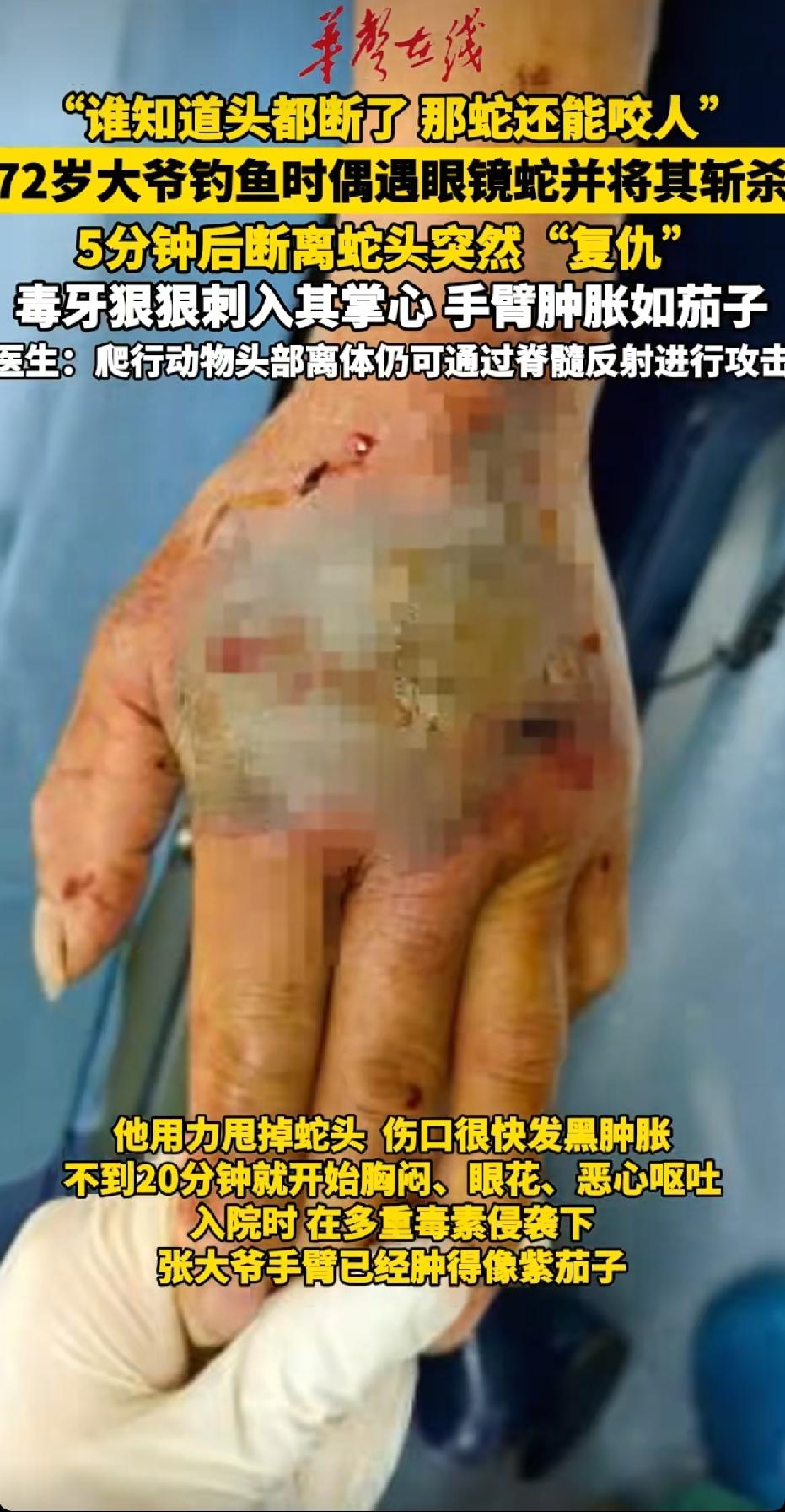 “谁知道头都断了，那蛇还能咬人”！7月29日报，5月份，一72岁大爷钓鱼时杀死剧