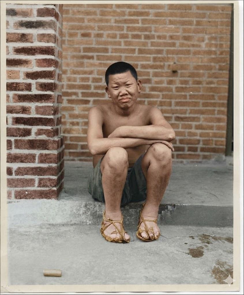 江门麻风病院，一位年轻麻风病人蜷缩在红砖建筑的台阶上，赤裸着上身，双臂交叉抱在膝