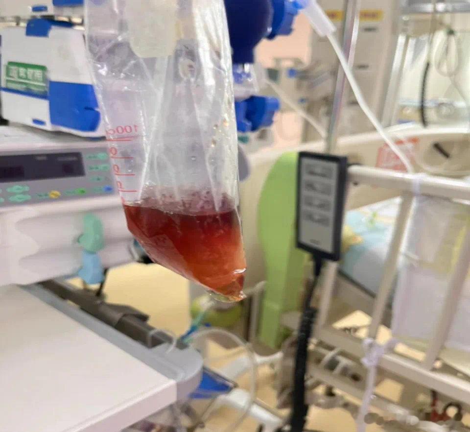 【吃了一包零食，5岁娃进了ICU！这些人最易被这种恶疾“盯上”】蚕豆病G6PD缺