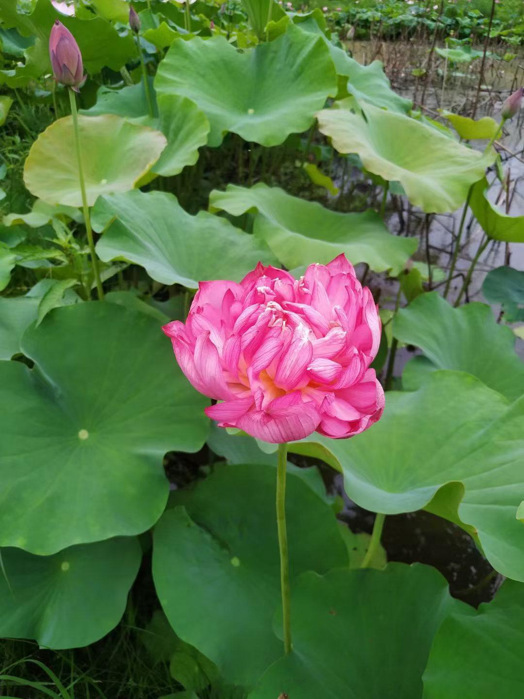 #很多癌症都源于慢性炎症背景#肝炎患者平时腹胀，腹泻，大便稀，不粘，这是典型的太阴病，应该用理中汤，
