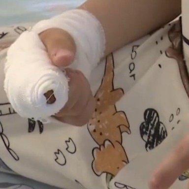 最近湖南有个5岁男童乐乐的事，让好多家长都揪着心——这孩子啃手指啃了两年多，家长