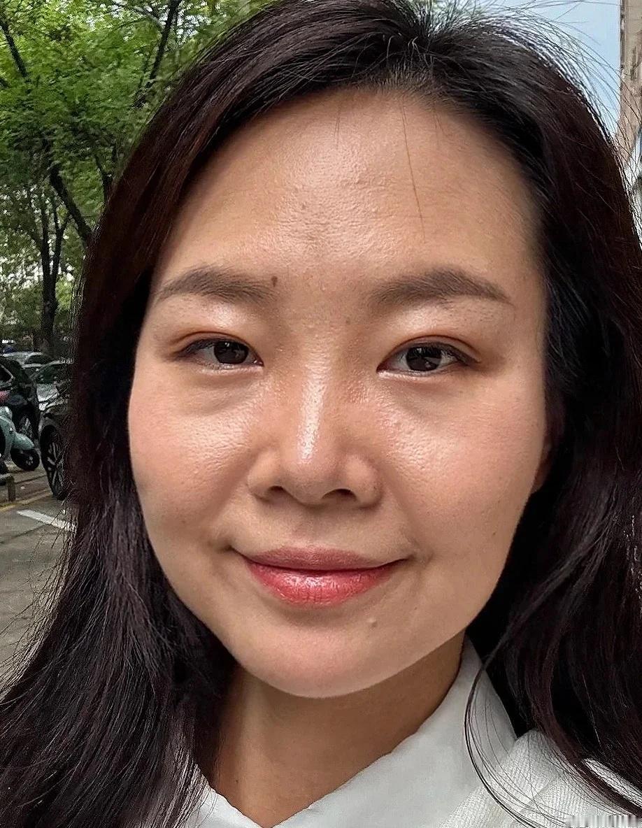 36岁，4w小调，有年轻5岁吗感觉上镜了好多