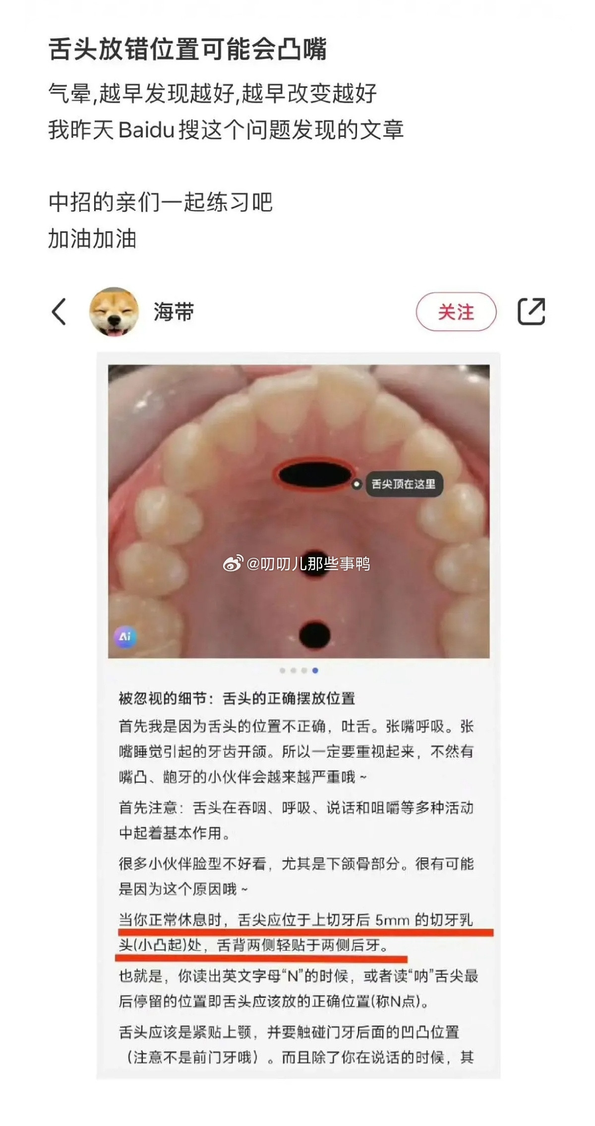 大家舌头位置放哪儿了？放错位置可能会凸嘴~​​