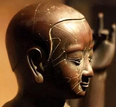 日本惊现“针灸铜人”轰动了整个中医学界，专家却称：这不可能！东京一家私立博物