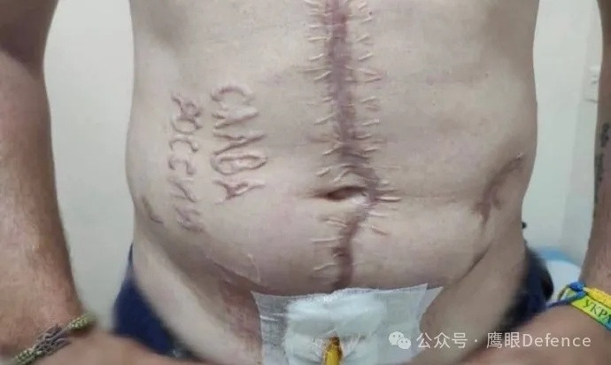 烽火问鼎计划今天，我不再谈论那些换俘中的感人瞬间，因为我看到了更令人发指的事：