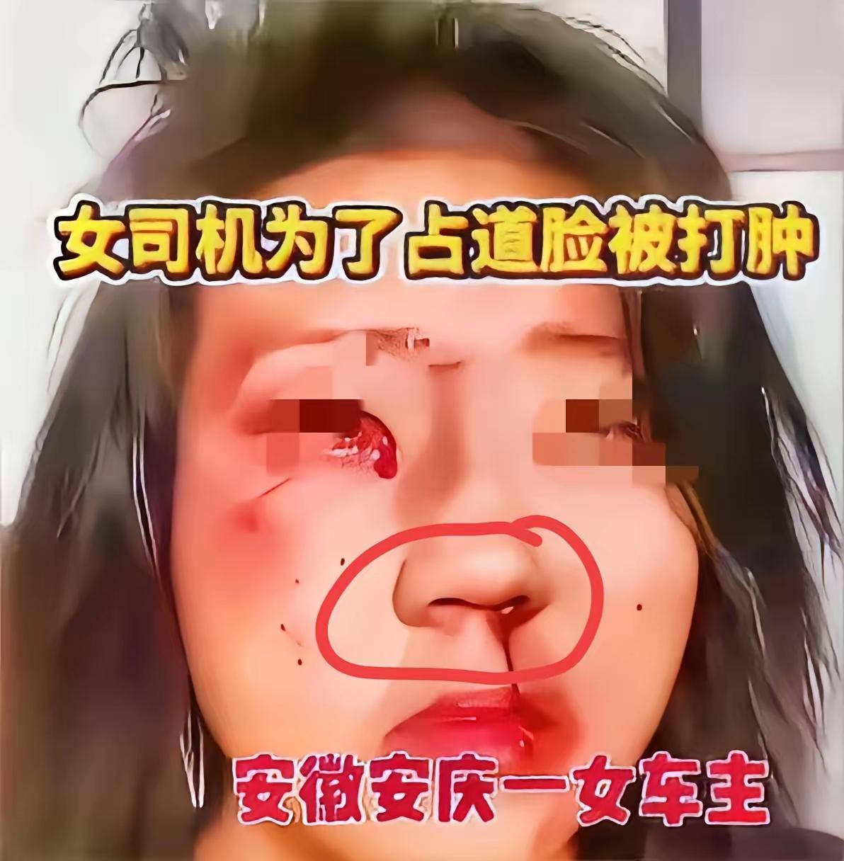 25码龟速堵8公里，还边打视频边挑衅“有本事飞过去”，换谁不气炸？但后车大哥一动