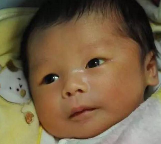 看到妈妈晒孩子的照片中, 医生朋友发现了孩子有“黄疸”