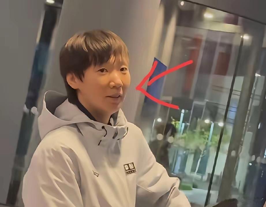 王曼昱回休息室的时候大家发现一个细节没有那就是她的嘴唇明显有点不一样，很苍白一点