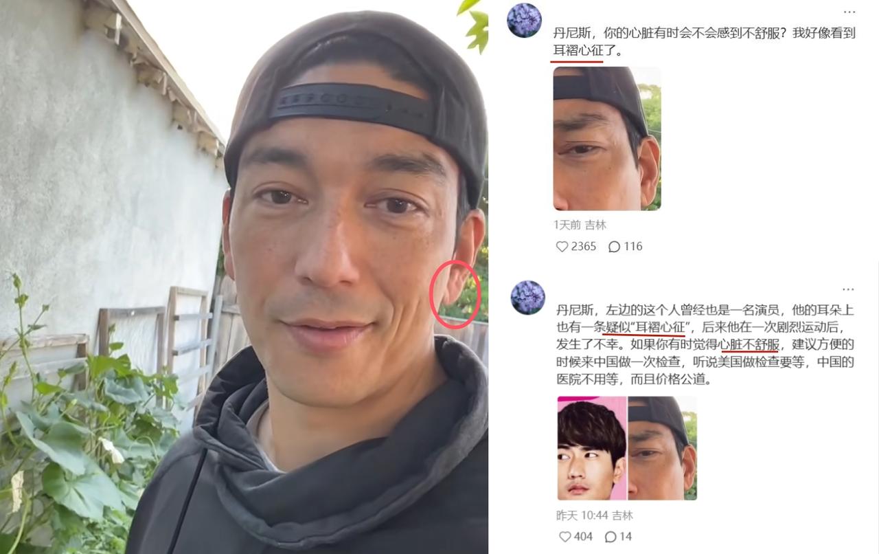 43岁男星耳垂疑似“耳褶心征”，网友：快去查心脏！近期，丹尼斯·吴，罕见发视频