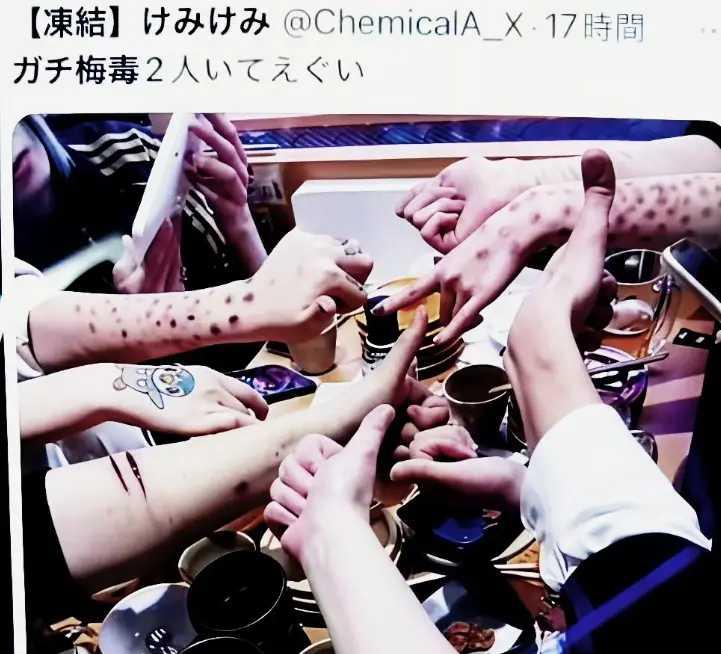 日本梅毒感染人数持续处于高位，年轻人聚众晒梅毒，为何会这样？日本梅毒单从数据上