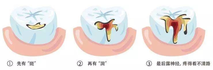 【冬季养生健康生活】嘴里的小问题, 现在不处理变成大麻烦