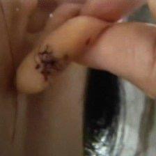 最近有个事儿让爱美的人心里直打鼓——杜女士花了2万8去整形机构做耳垂手术，本来想