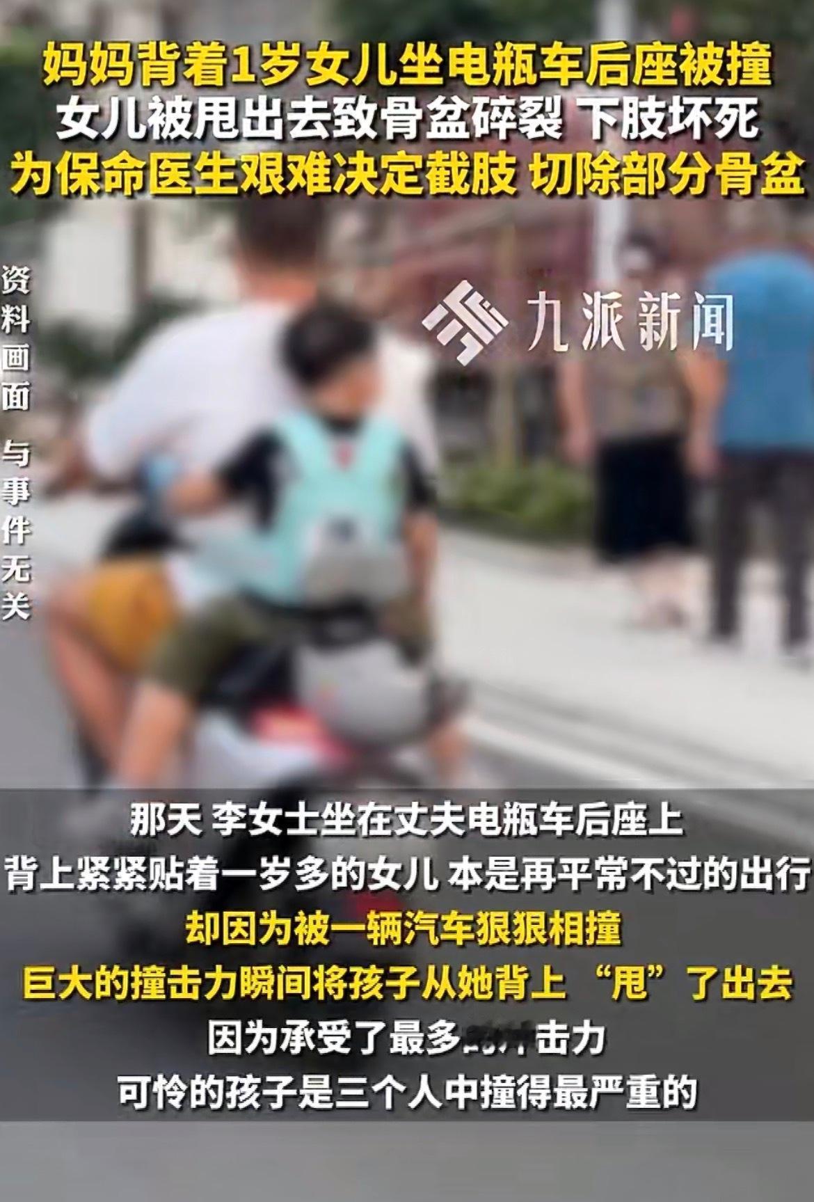 一个才一岁多的小宝宝，本该在爸妈怀里撒娇打滚，却因为一场车祸永远失去了左腿，还被