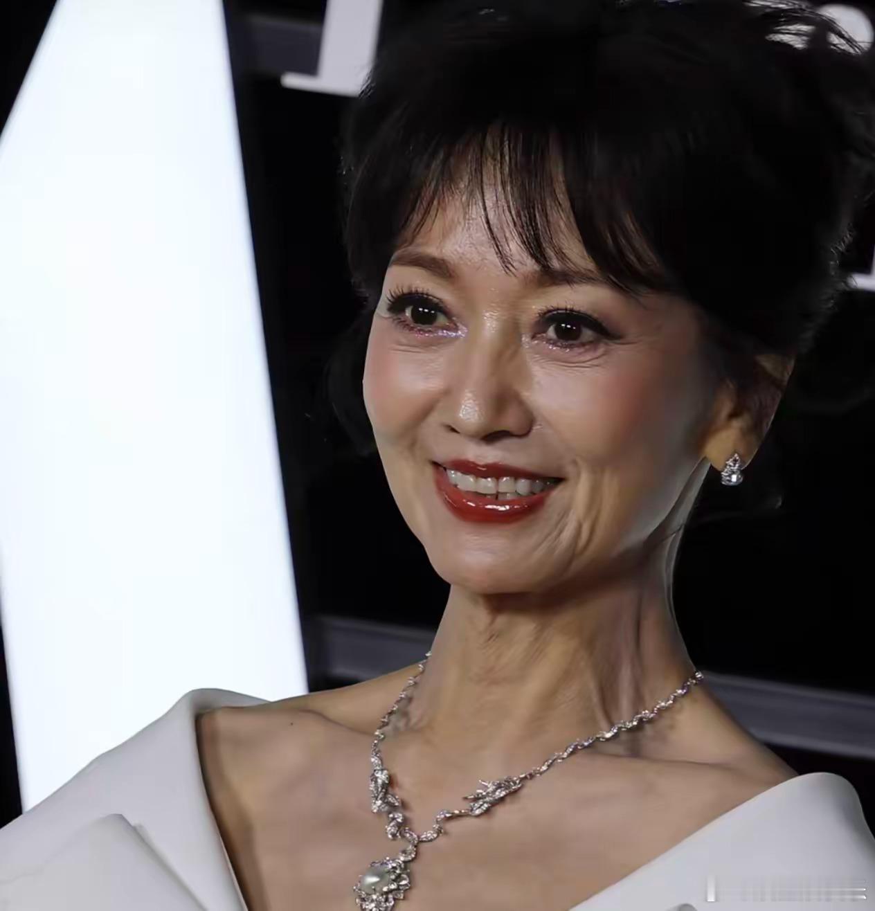 我做医美的朋友和我说别再说赵雅芝是不老女神了真实的她你想象不到，其实她的颈纹挺严