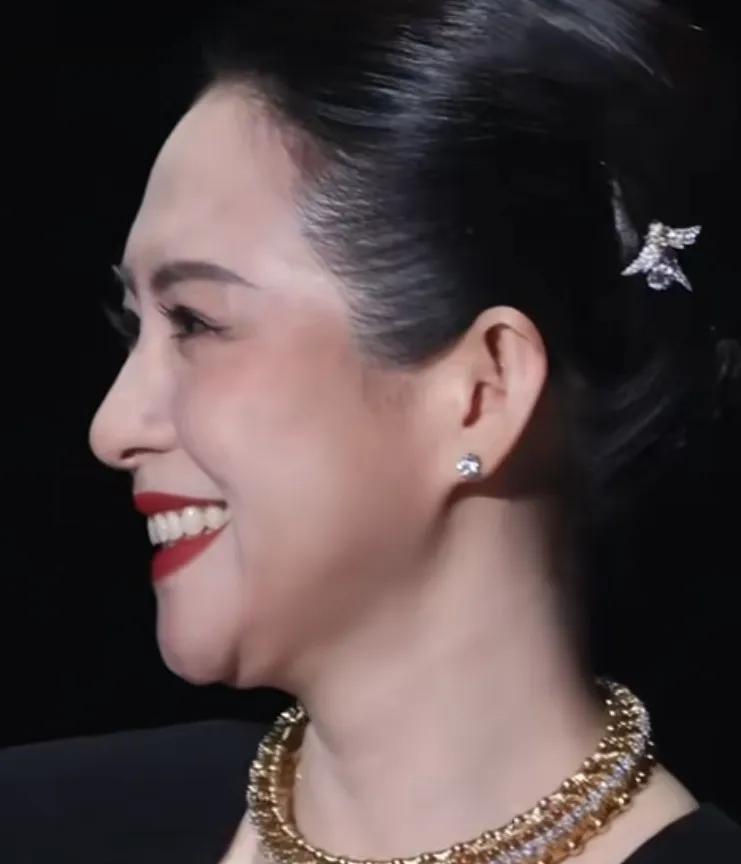 章子怡面部填充后猛一看像倪萍章子怡的瘦脸一夜之间肿成皮球，猛一看像倪萍。为啥面