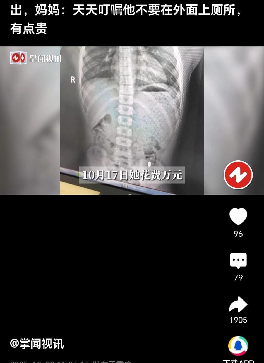 一男孩大便,她妈妈说:千万要在家里面上厕所!不要去外面。因为他的肚子里有宝贝