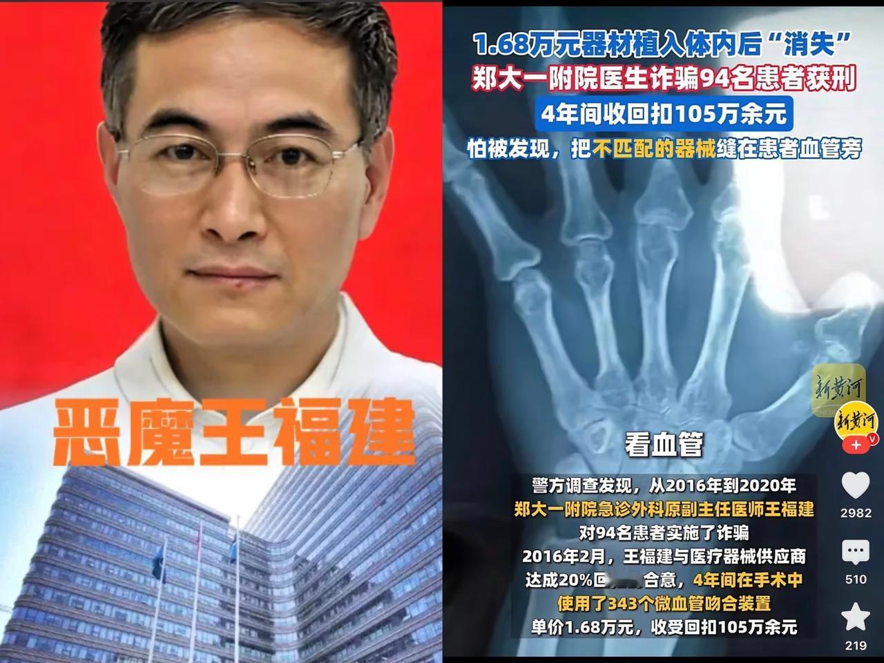 真是不敢看，这哪里是医生，分明是索命的恶鬼！彭先生断了4根手指，手术做了12个小