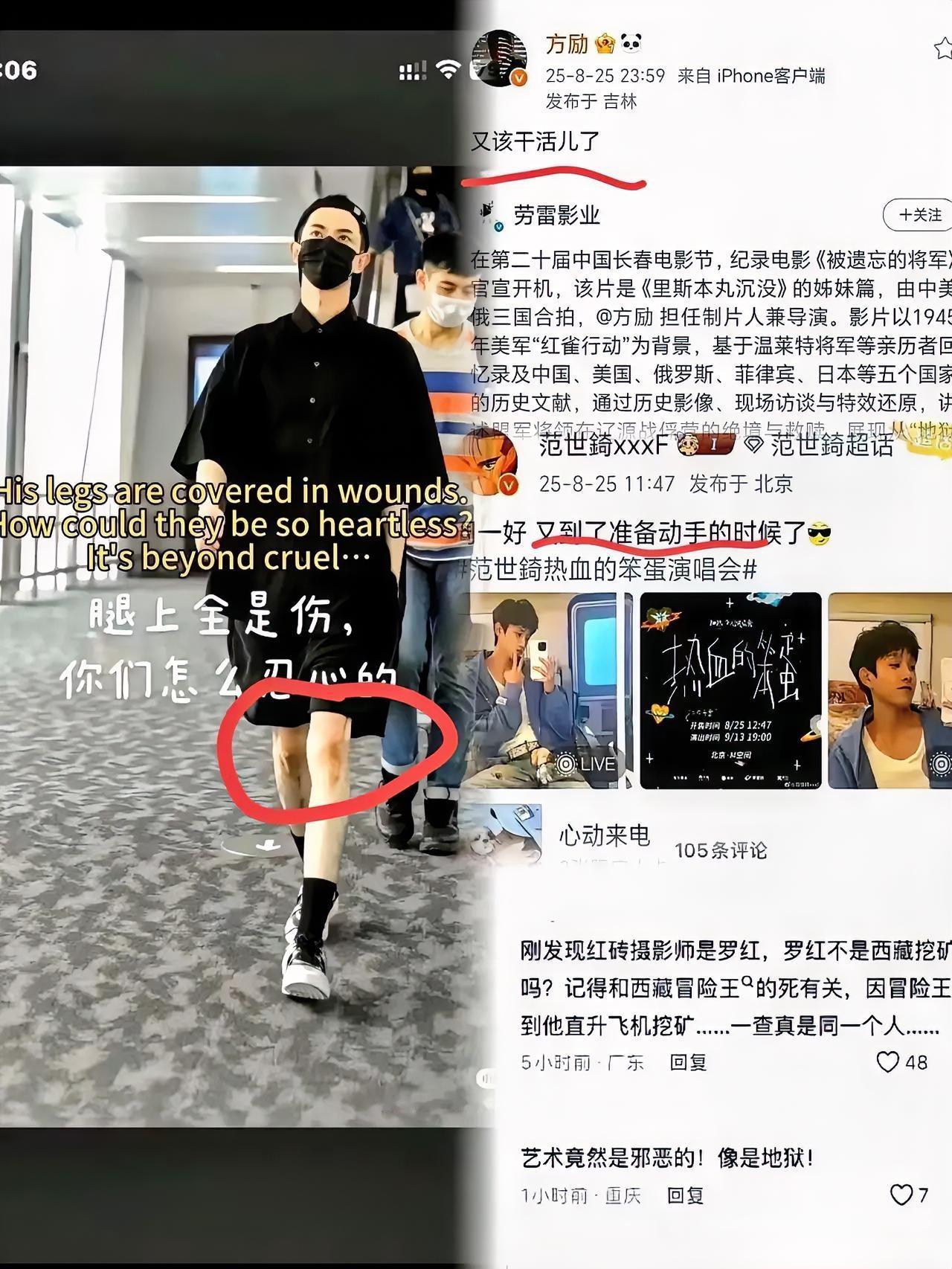 谁没对着那张照片反复放大啊？腿上那片淤青紫得发暗，盯着屏幕都能脑补出当时有多疼！