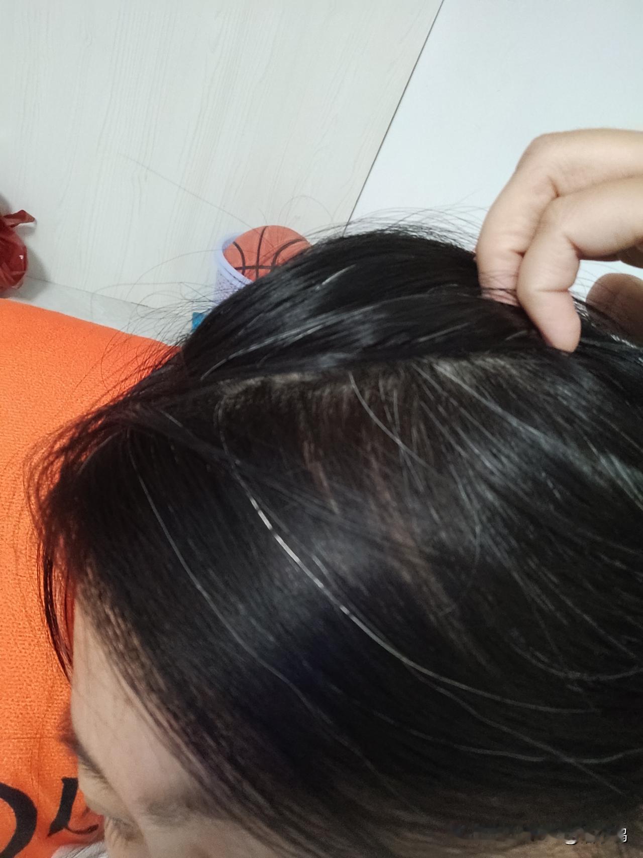 36岁半头白发，有没有人跟我一样的，不是因为遗传，也不是因为染发，我想大概就是累