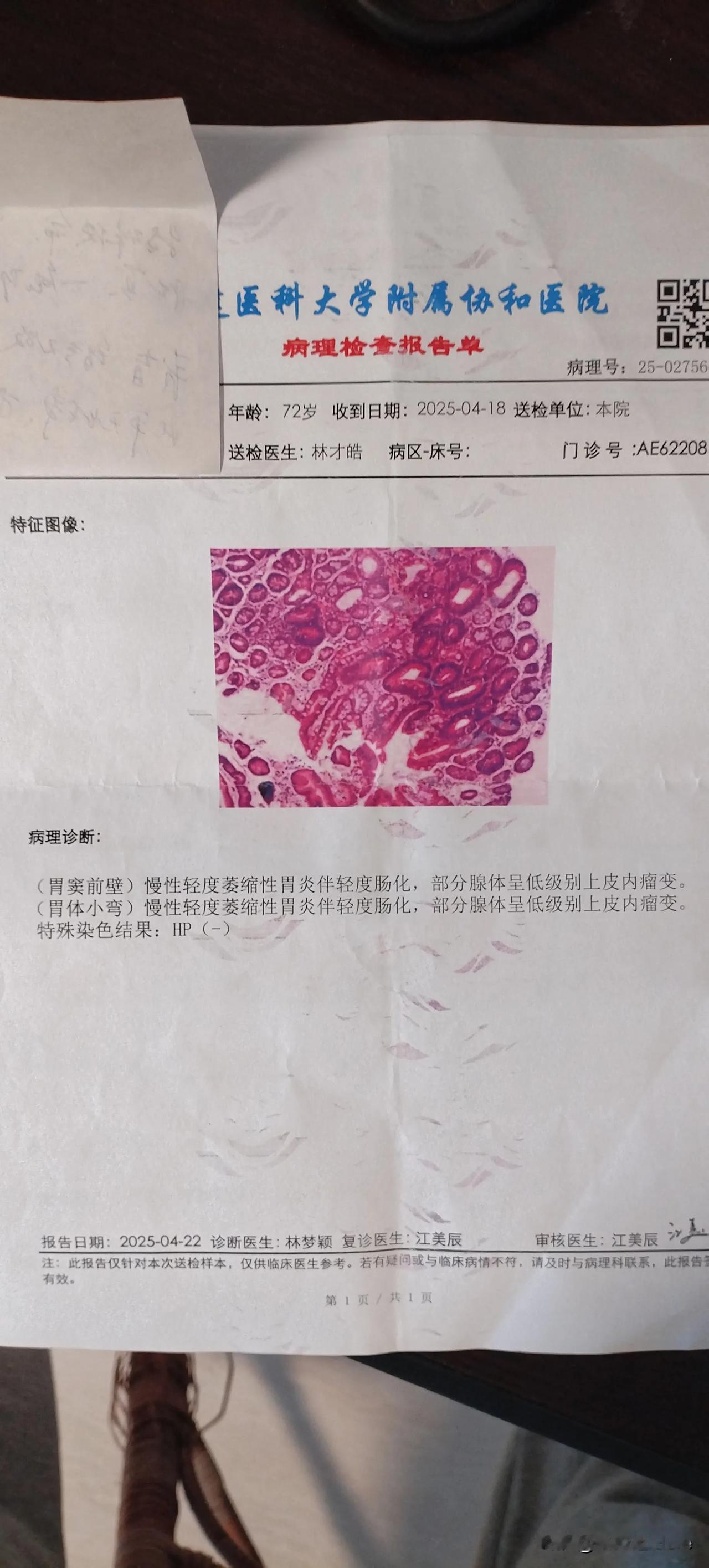 近日查胃镜，查出“部分腺体呈低级别上皮内瘤病”。这让我惶恐，癌前病变的节奏啊。于