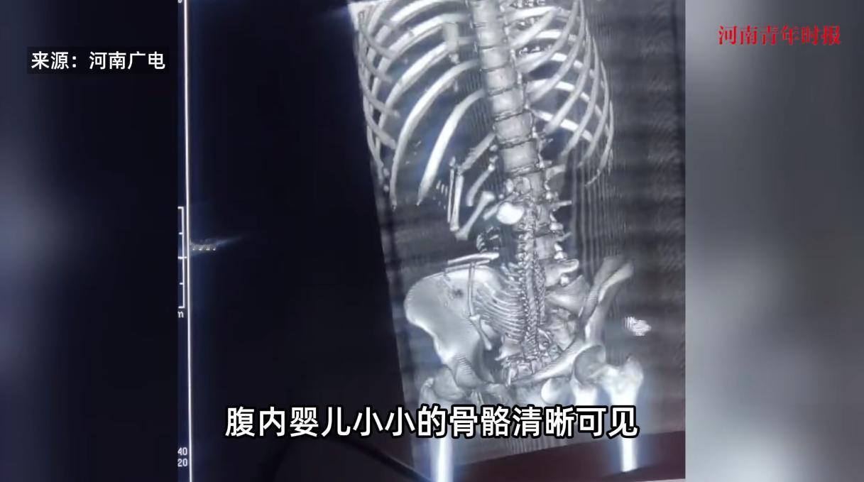 解释不清了！”19岁女生腹痛难忍，母亲将其送到医院，医生反复询问是否怀孕，结果女