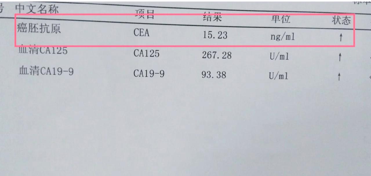 体检发现肿瘤标志物升高、出现小箭头，很多人都会瞬间心慌，误以为自己离癌症不远了。