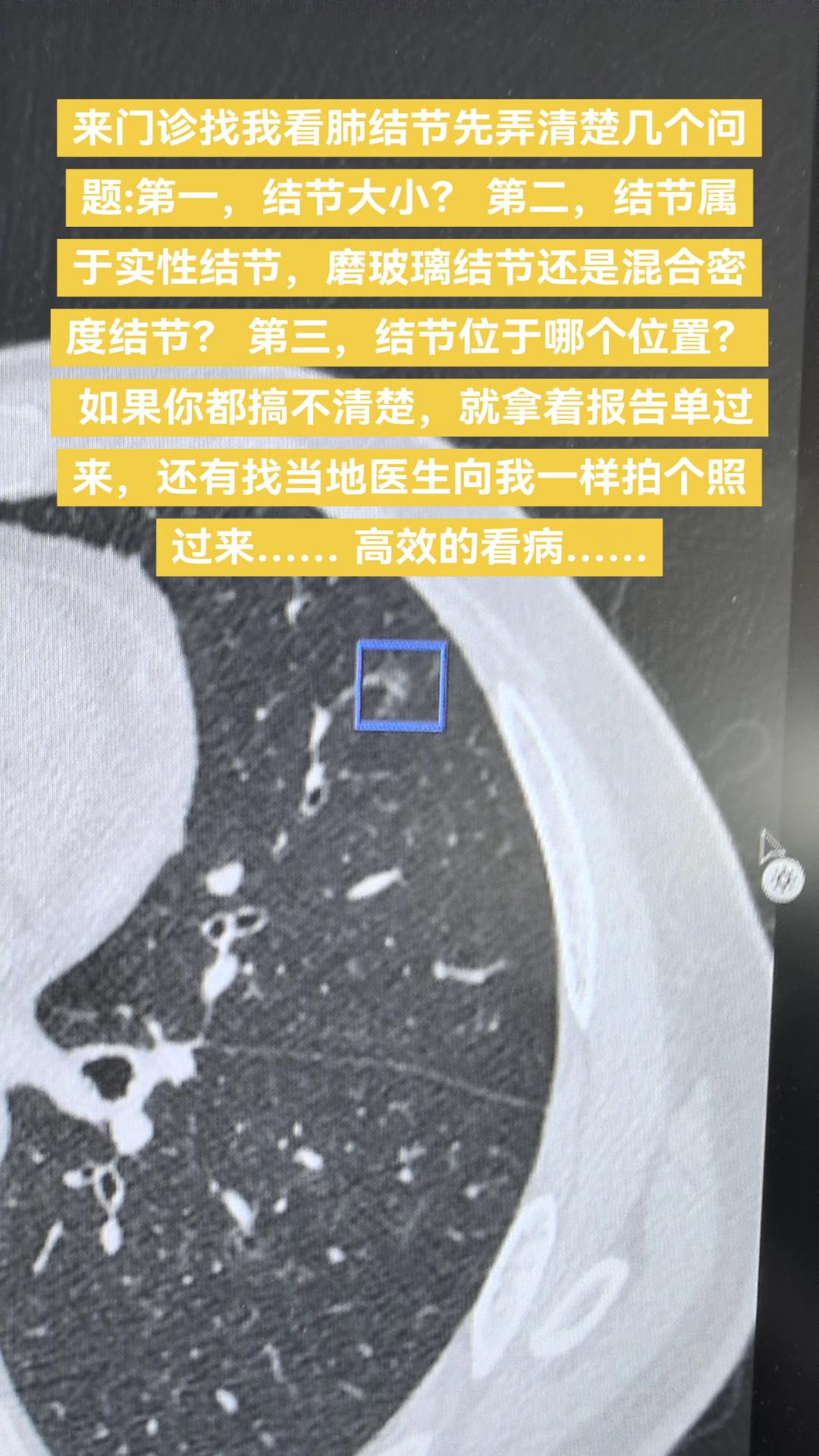 如何高效的看肺结节？来门诊找我看肺结节先弄清楚几个问题:第一，结节大小...