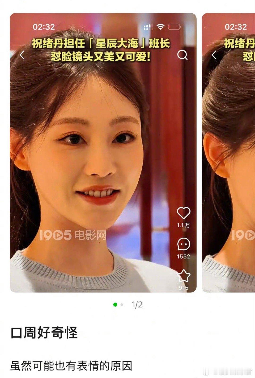 祝绪丹嘴巴被网友说很奇怪，是变了吗