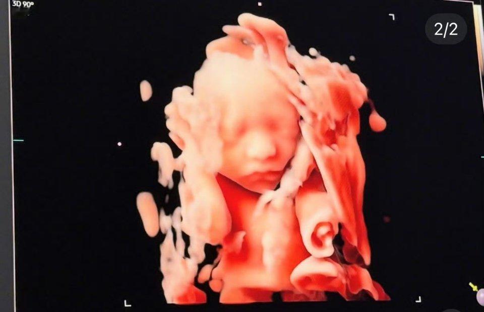 宋承炫宣布当爸古早的男神官宣当爸爸了！好幸福的一家人，已经感觉到小孩会是五官精美