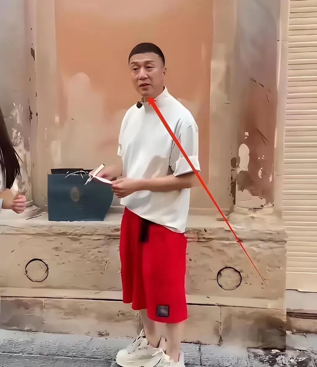 总觉得他比以前帅了一点，可能去医美了吧，你看他的眼睛好像和之前不一样，总有一种说