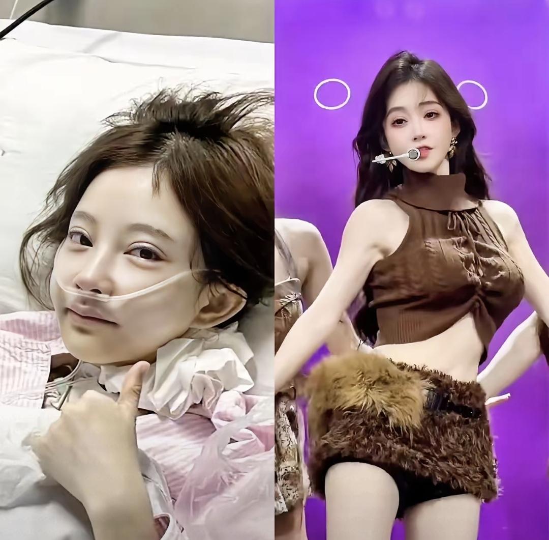 冯提莫34岁确诊两次甲状腺癌，刚做完手术就又开始直播唱歌，现在还搞起团播又唱又跳