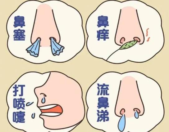 反馈最好的鼻炎方子，最快三天搞定你的鼻炎，放在圈子功德无量！今天，我要跟大家分