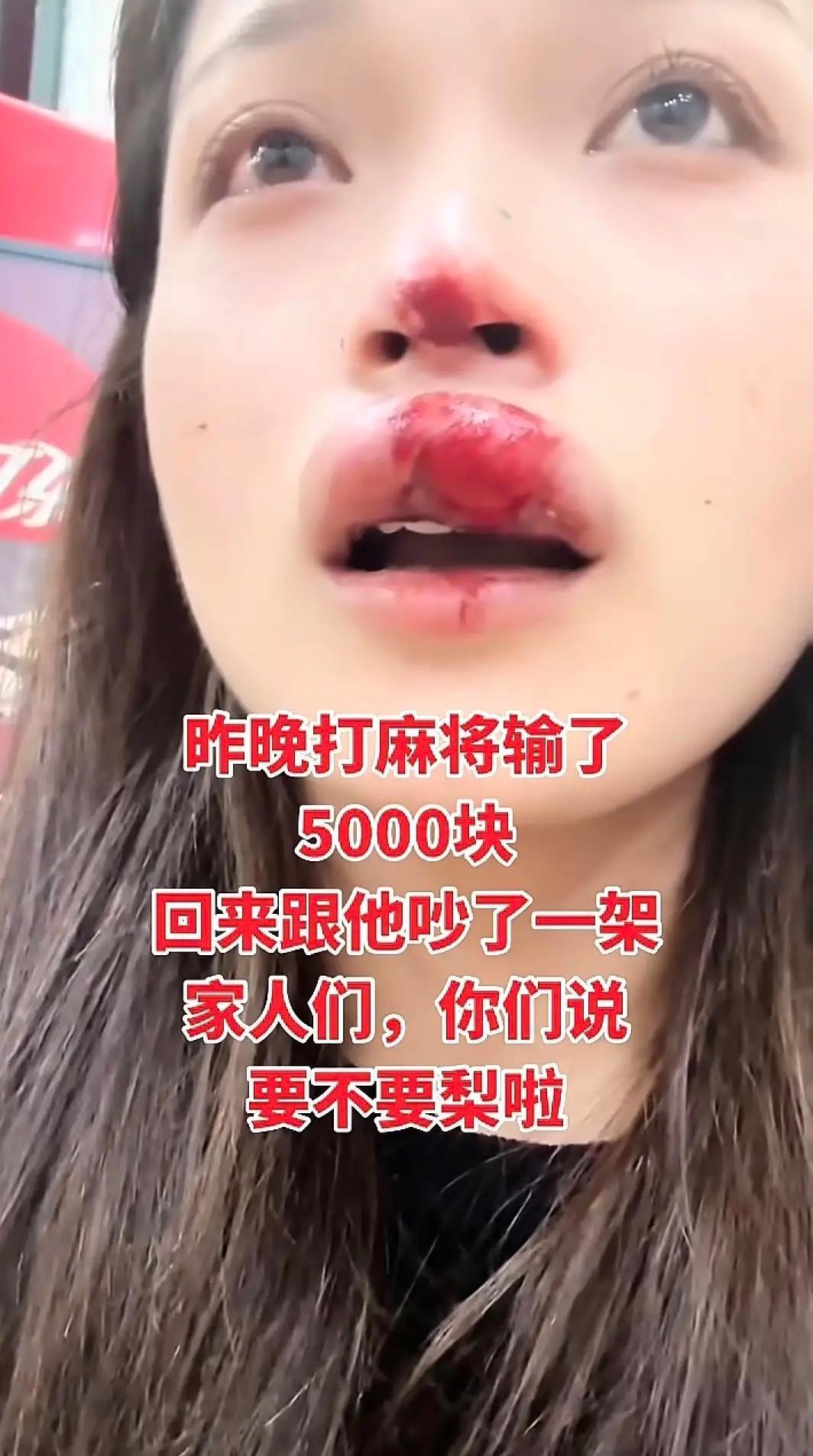 昨晚打麻将输了5000块，回来跟他吵了一架，家人们，你们说要不要离啦……昨晚打