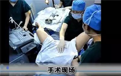 十张图让你看懂试管婴儿全过程, 看完心疼女人
